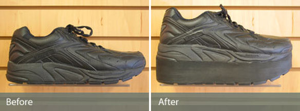 Pedorthic Shoe Modifications - footmarkcped